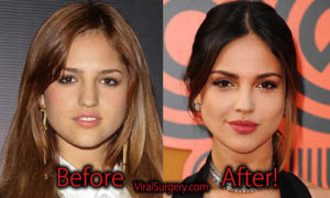 Eiza Gonzalez Plastic Surgery Before And After Nose Job Pictures