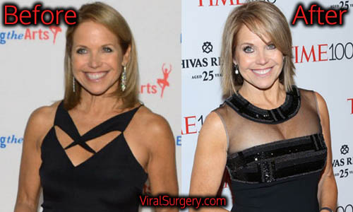 Katie Couric Tits 35