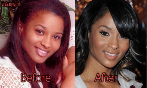 ciara before and after skin bleaching