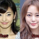 Han Ye Seul Plastic Surgery Before and After Pictures
