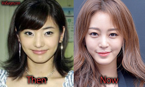 Han Ye Seul Plastic Surgery Before And After Eyelid