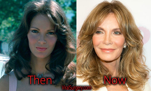 Jaclyn Smith Plastic Surgery Facelift