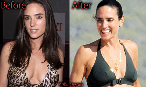 Jennifer Connelly Plastic Surgery Breast Reduction Picture.