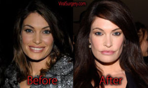 Kimberly Guilfoyle without makeup atom heart mother album cover
