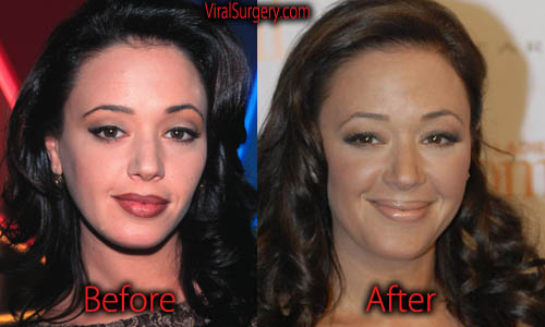 Leah Remini Plastic Surgery: Before and After Botox, Boob Job Pictures.