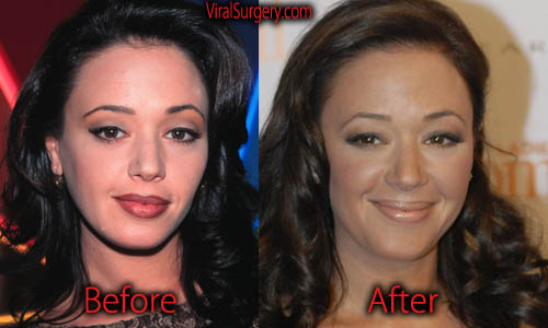 Leah Remini Plastic Surgery: Before and After Botox, Boob Job Pictures