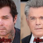 Ray Liotta Plastic Surgery Before and After Pictures