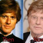 Robert Redford Plastic Surgery Before and After Pictures