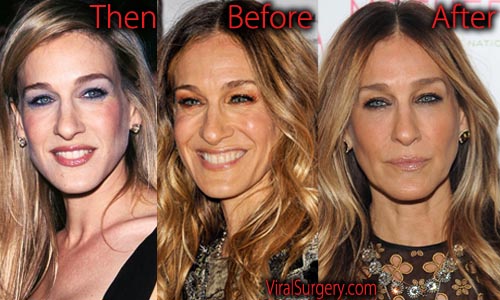 Sarah Jessica Parker Plastic Surgery: Before and After Boob Job Pictures.
