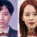 Song Ji Hyo Plastic Surgery Before and After Pictures