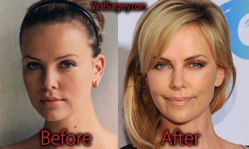 Charlize Theron Plastic Surgery, Before and After Nose Job Pictures