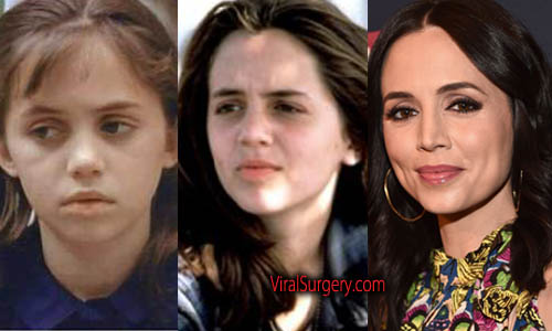 Eliza Dushku Plastic Surgery, Before After Nose Job Pictures.