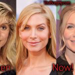 Elizabeth Mitchell Plastic Surgery, Before After Facelift Pictures