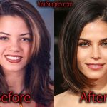 Jenna Dewan Plastic Surgery Before and After Pictures