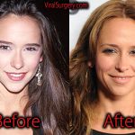 Jennifer Love Hewitt Plastic Surgery, Before and After Pictures