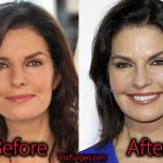 Sela Ward Plastic Surgery, Before and After Botox Pictures