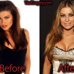 Carmen Electra Plastic Surgery, Before After Boob Job Pictures