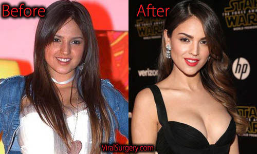 Eiza Gonzalez Plastic Surgery, Before and After Photo.