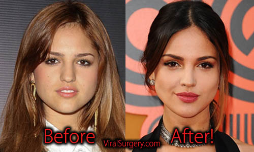 Eiza Gonzalez Plastic Surgery, Before and After Nose Job Picture.