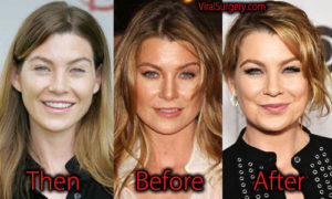 Ellen Pompeo Plastic Surgery, Before and After Botox Rumor Pictures