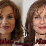 Isabelle Huppert Plastic Surgery Before After Facelift, Botox Pictures