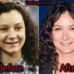 Sara Gilbert Plastic Surgery, Before and After Nose Job Pictures