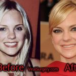 Anna Faris Plastic Surgery, Before and After Pictures