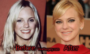 Anna Faris Plastic Surgery: Before and After Pictures