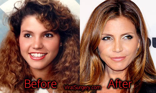 Charisma Carpenter Plastic Surgery, Before and After Boob Job Picture