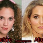 Elizabeth Berkley Plastic Surgery, Before After Botox Pictures