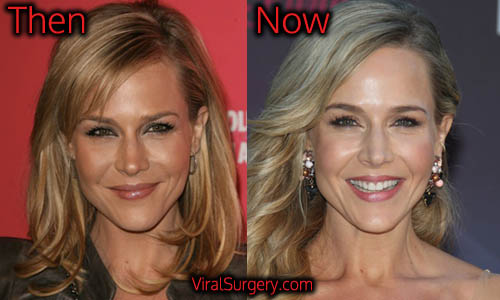 julie benz before and after implants