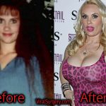 Coco Austin Plastic Surgery, Before and After Photos