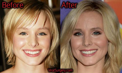 Kristen Bell's Transformation: Photos From Young to Now