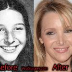 Lisa Kudrow Plastic Surgery, Before and After Nose Job Pictures