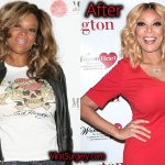Wendy Williams Plastic Surgery, Before and After Liposuction Pictures