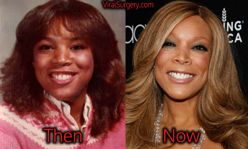 Wendy Williams Plastic Surgery, Nose, Face