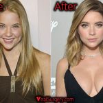 Ashley Benson Plastic Surgery, Before and After Boob Job Photo