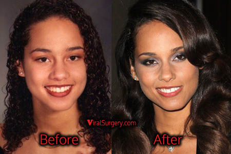 Alicia Keys Nose Job, Before After Photo.