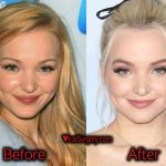 Dove Cameron Plastic Surgery Nose Job, Before and After Pics