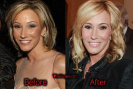 Paula White Plastic Surgery, Before and After Facelift ...