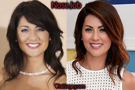 Jillian Harris Plastic Surgery Nose Job