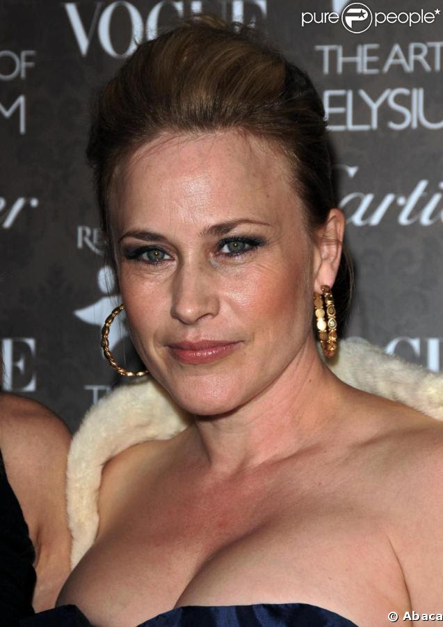 Patricia Arquette Cosmetic Surgery Face