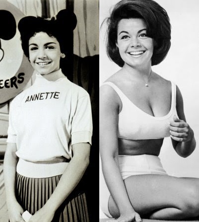 Annette Funicello Cosmetic Surgery Body