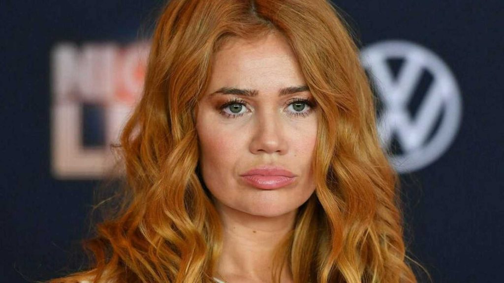 Palina Rojinski Cosmetic Surgery