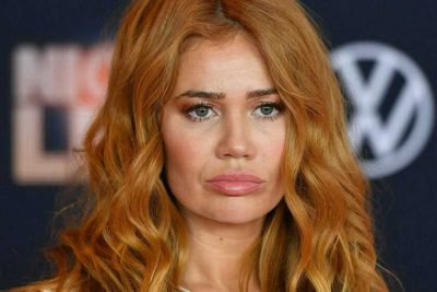 Palina Rojinski Cosmetic Surgery