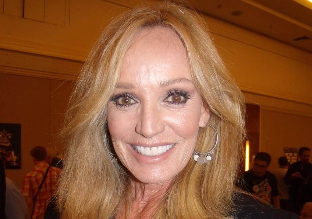 Susan Anton Cosmetic Surgery Face