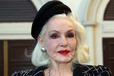 Julie Newmar Plastic Surgery Procedures