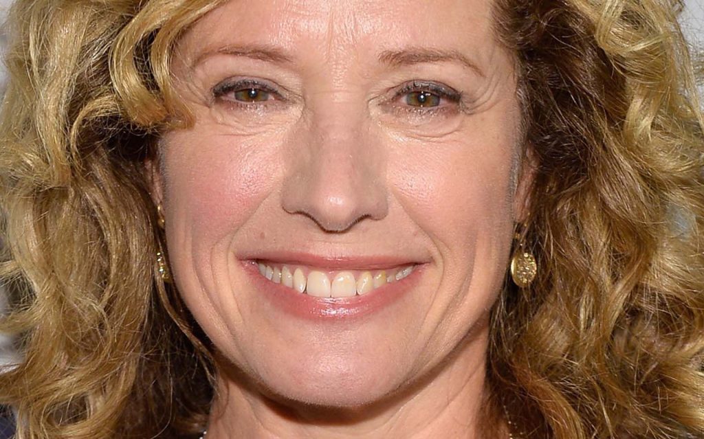 Nancy Travis Cosmetic Surgery