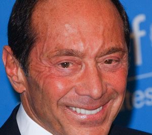 Paul Anka Plastic Surgery